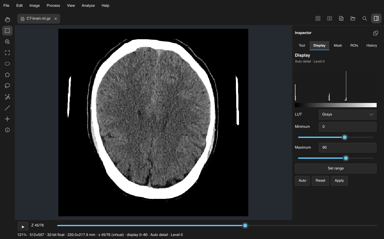 Oxel showing acquired CTBrain slice 45 of 76, with Display minimum 0 and maximum 80.