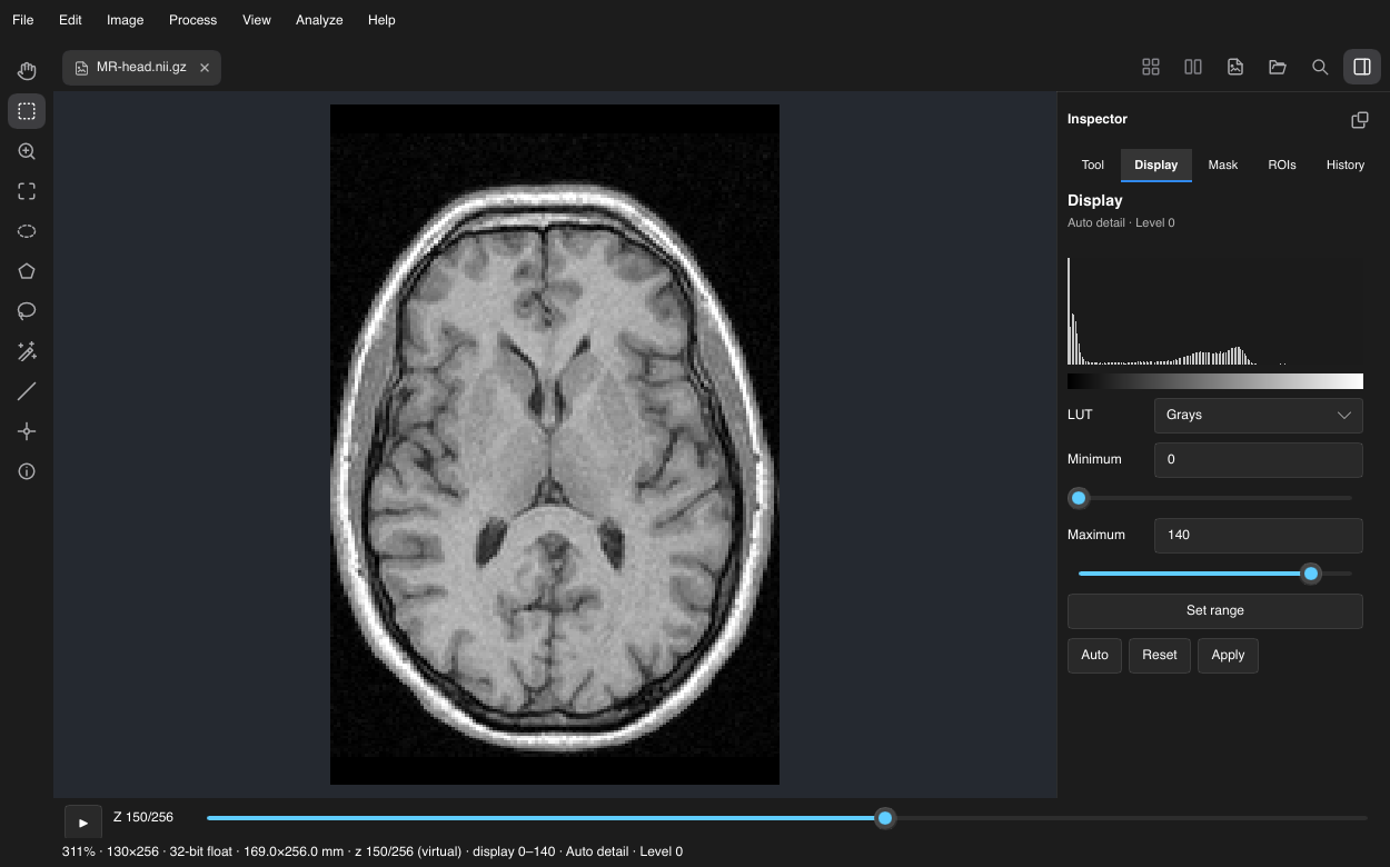 Oxel showing an axial MRHead MRI plane, slice 150 of 256 after axis reorientation, with Display range 0 to 140.