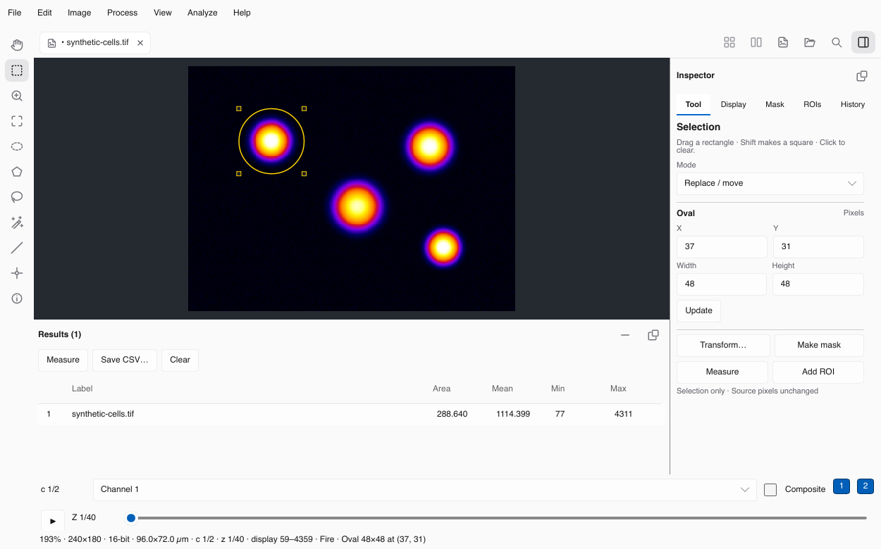 A calibrated oval measurement in synthetic demonstration data. Results accumulate in the table; Save CSV saves the numerical record separately from the image.